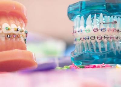 درمان ارتودنسی چگونه به نظم دندان ها کمک می کند؟