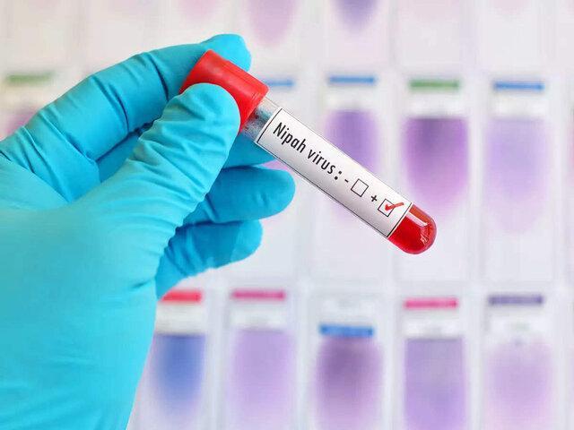 خطر همه گیری ویروس شایع شده در مناطقی از آسیا خطر همه گیری ویروس شایع شده در مناطقی از آسیا