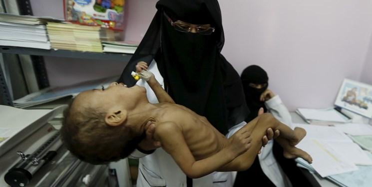 آمار رسمی ، هر 5 دقیقه یک کودک یمنی می میرد