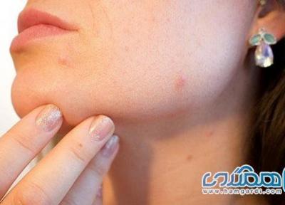 کرونا چه تاثیری بر روی پوست دارد؟