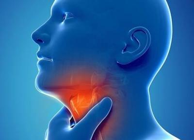علت برفک دهانی (عفونت دهان) چیست؟