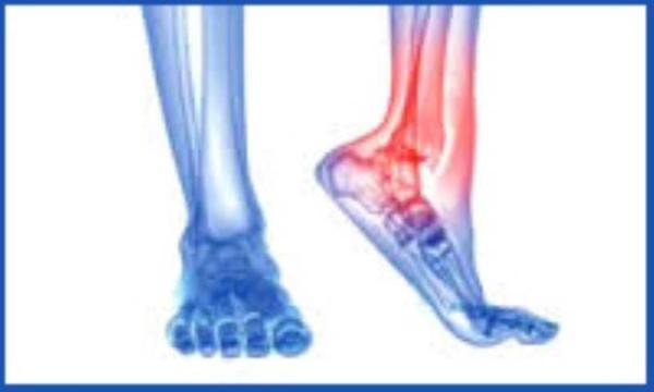 نگاهی به علائم و نشانه های اصلی درد پا در افراد دیابتی نگاهی به علائم و نشانه های اصلی درد پا در افراد دیابتی