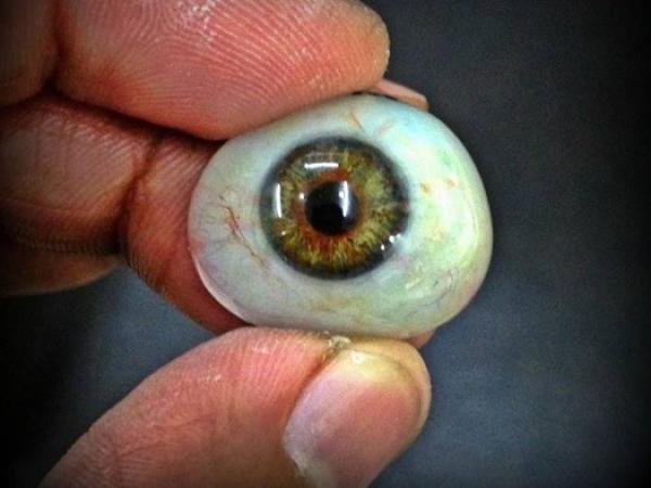 پروتز چشم: نحوه ساخت، قرار دادن، مراقبت و هزینه چشم مصنوعی